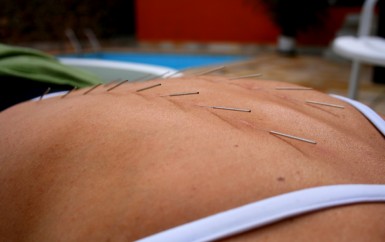 <!--:es-->La acupuntura es un buen aliado para minimizar los efectos secundarios de la quimioterapia, según la Asociación de Oncología Integrativa<!--:-->